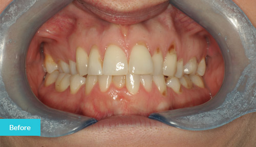 Case 10 Befor