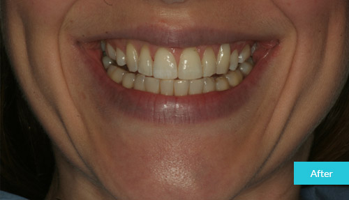 Case 10 After