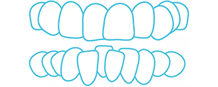 Crossbite Blue Icon
