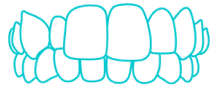 Crossbite Blue Icon