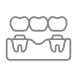 Dental Bridges