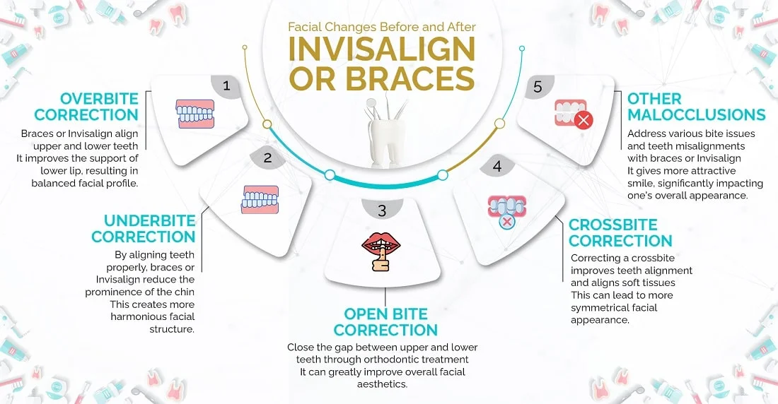 Facial Changes Before and After Invisalign or Braces
