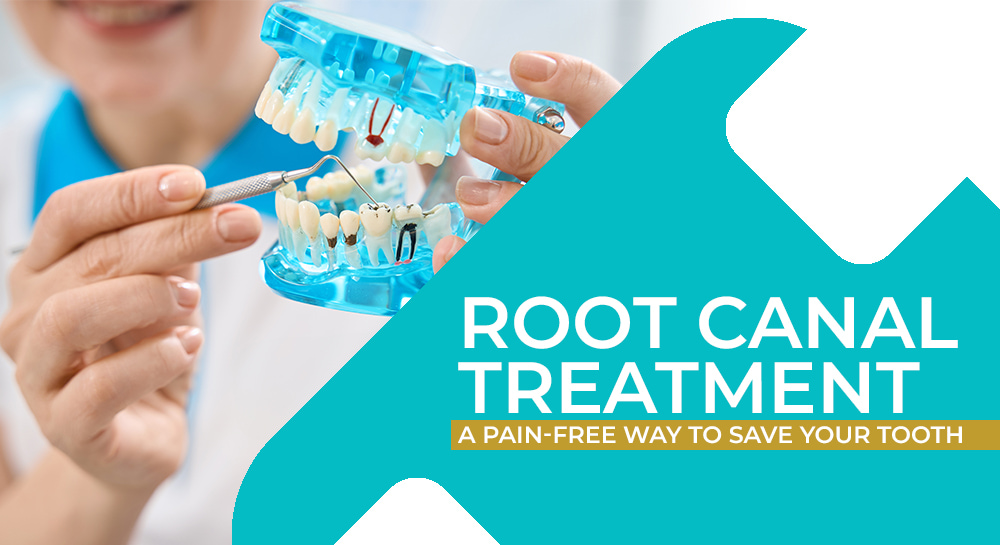 Root Canal Treatment: A Pain-Free Way to Save Your Tooth