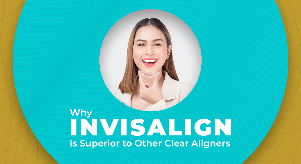 Why Invisalign is Superior to Other Clear Aligners