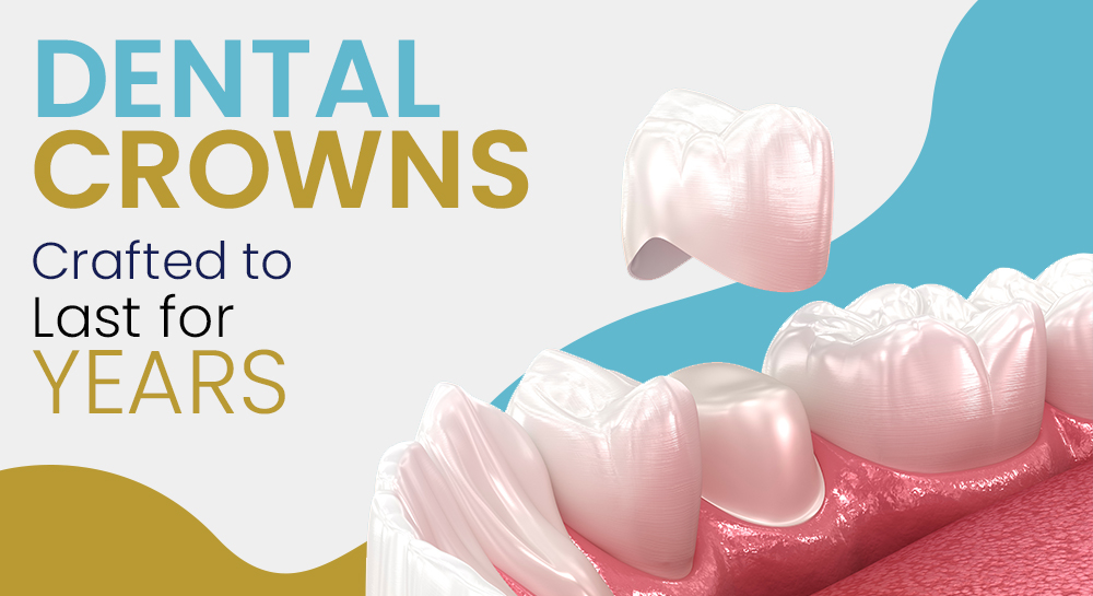 Dental Crowns Crafted to Last for Years