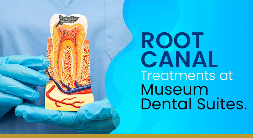 Root Canal Treatments at Museum Dental Suites