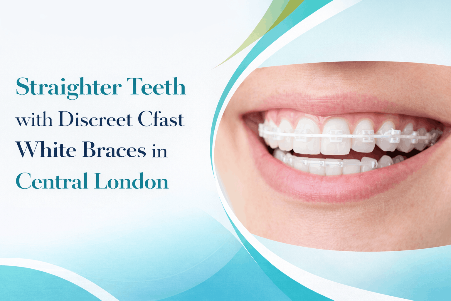 Straighter Teeth with Discreet Cfast White Braces in Central London