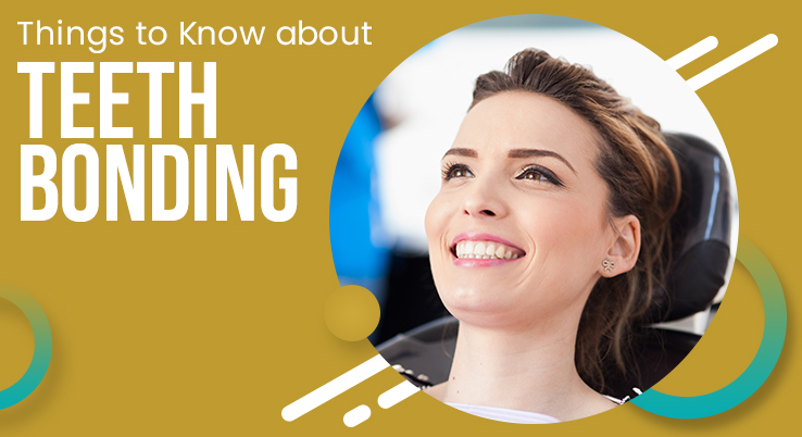 What You should Know About Teeth Bonding