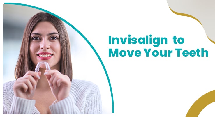 How Are Teeth Moved Through Invisalign Treatment