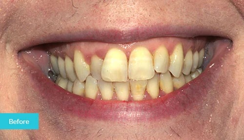 1601446618243case2_before