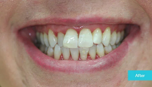1601446618999case2_after