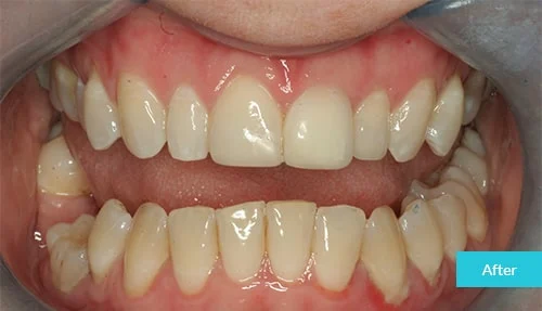 case1-after