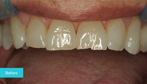 case10-before