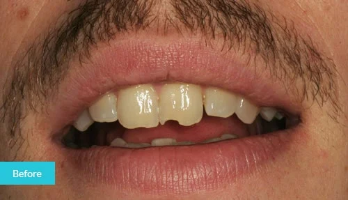 case11-before