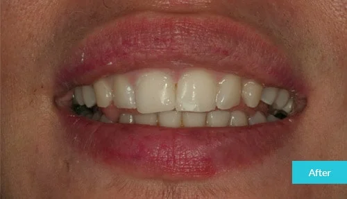 case12-after
