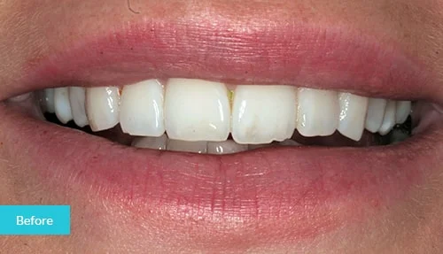 case13-before