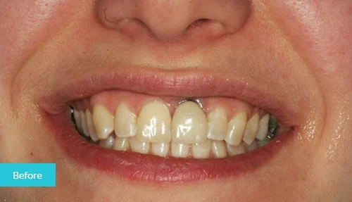 case15-before