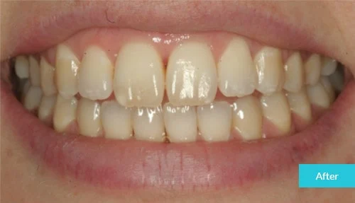case16-after