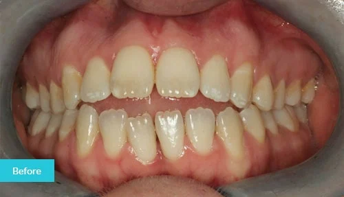 case16-before