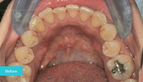 case17-before
