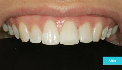 case18-after