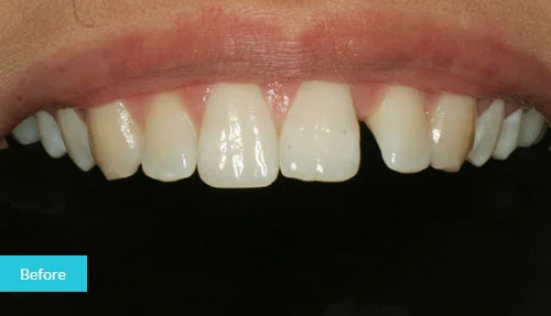 case18-before