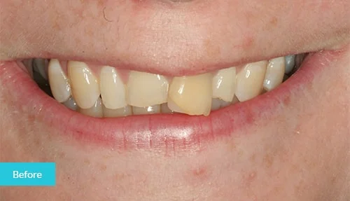 case2-before