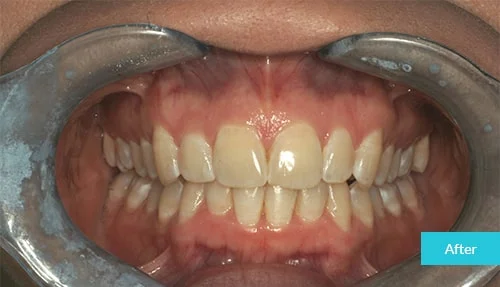 case3-after
