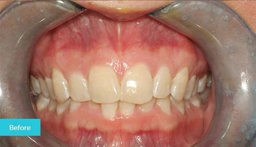 case3-before