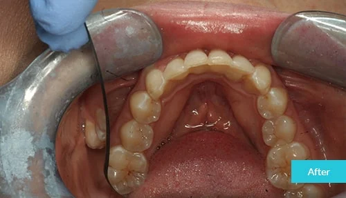 case4-after