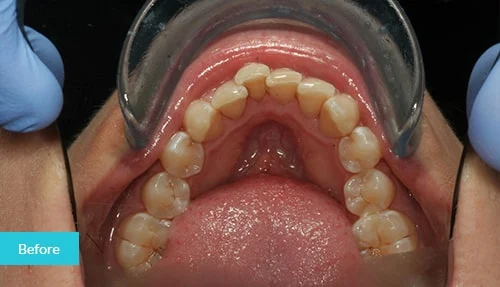 case4-before