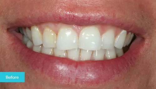 case5-before