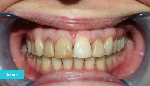 case6-before