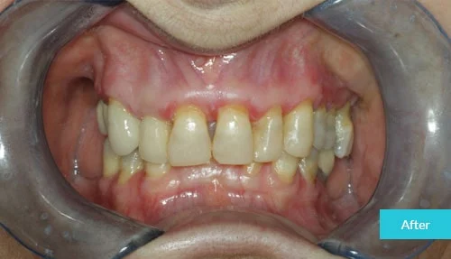 case8-after