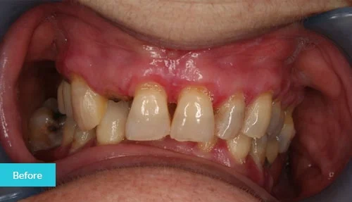 case8-before