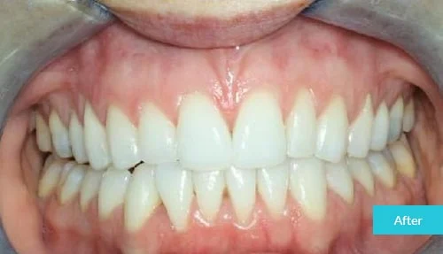 case9-after
