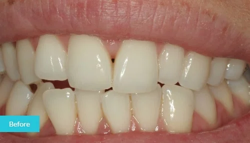 case9-before